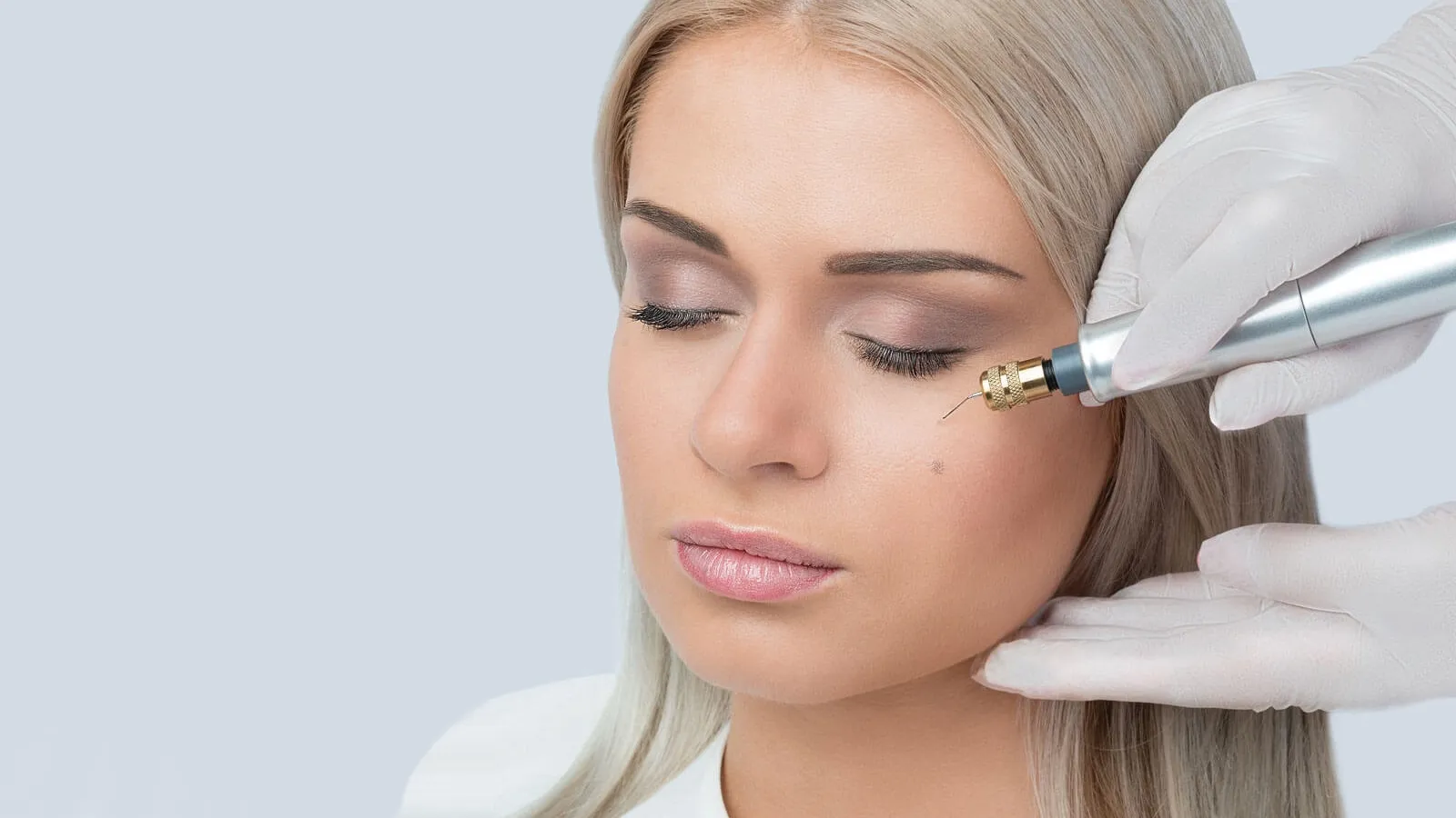 Plasma Fibroblast Skin Lift