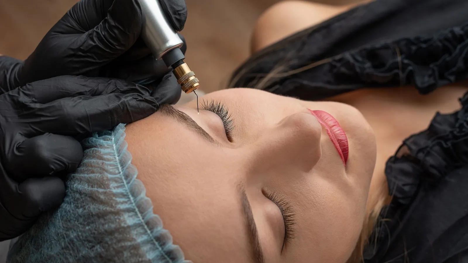 Plasma Fibroblast Skin Tightening