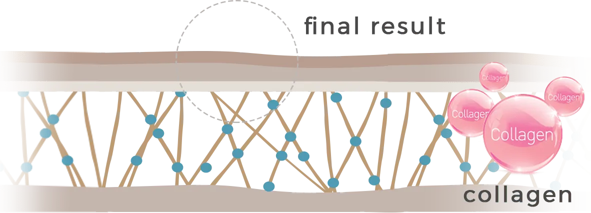 Plasma Generating Collagen and Elastin